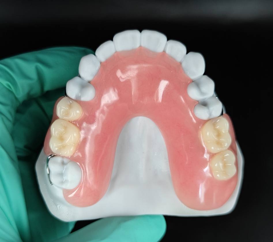 Acrylic Denture (Full/ Partial Denture)