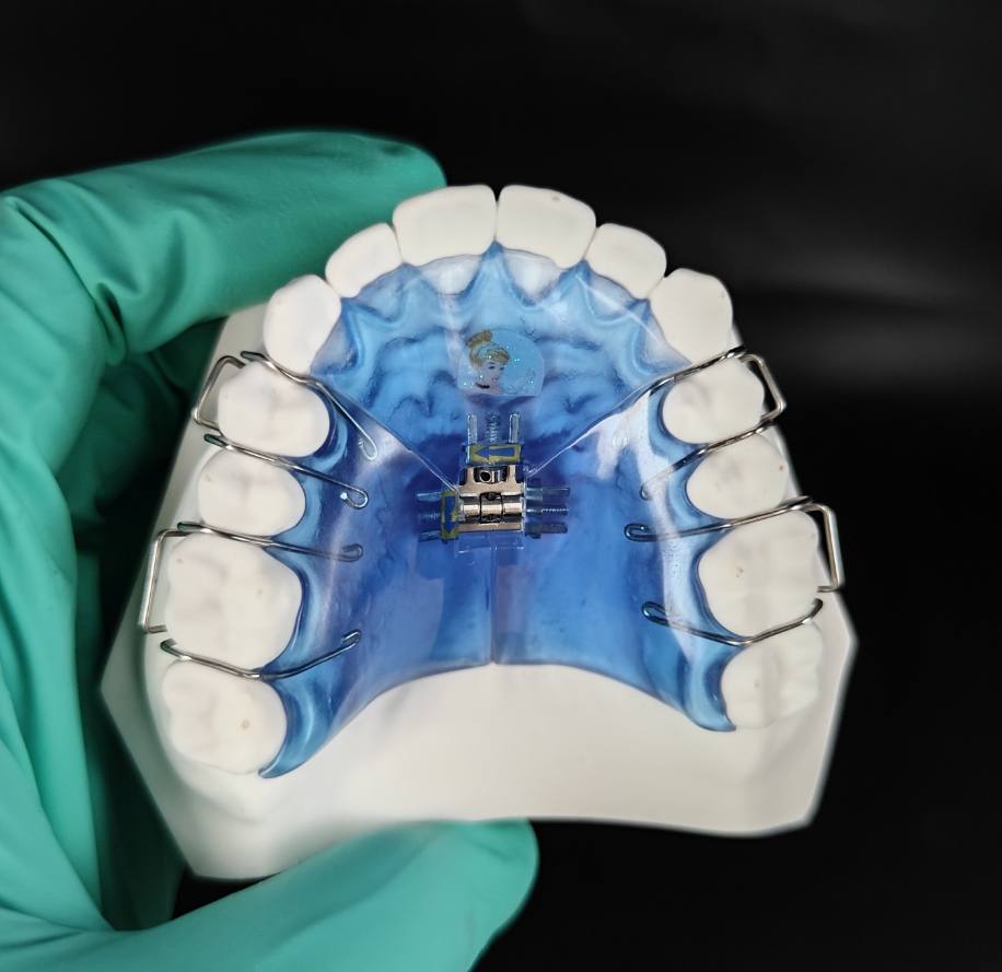3 way expander
