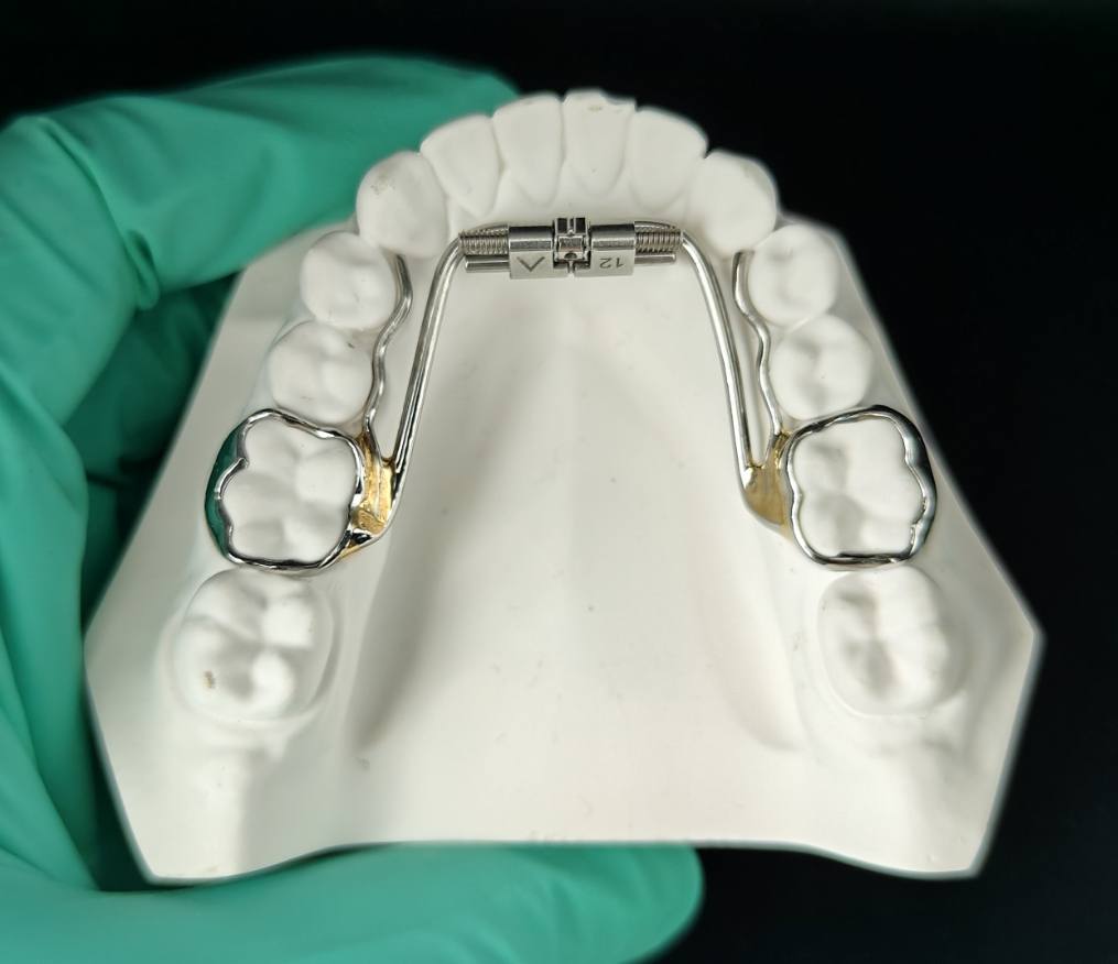 Rapid palatal expander