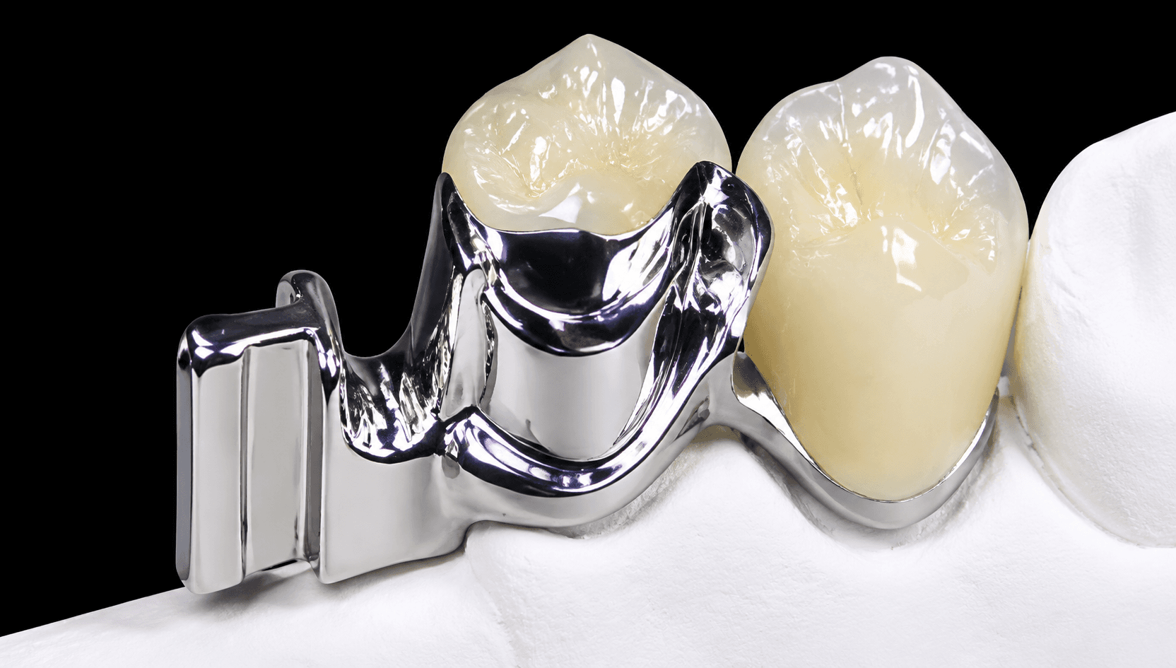 ERA Attachment